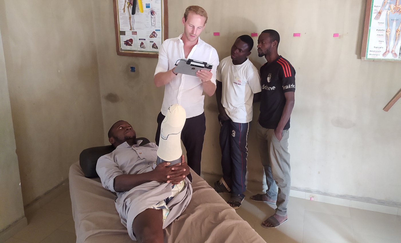 Deze Belgische start-up maakt met behulp van 3D-scans en -printers betaalbare protheses voor ontwikkelingslanden